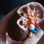Chronic Kidney Disease: What You Need to Know