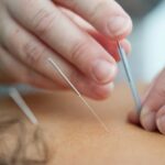 Cómo la acupuntura puede ayudar con la autocuración y el bienestar
