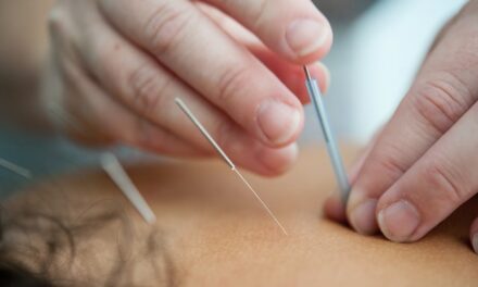 Cómo la acupuntura puede ayudar con la autocuración y el bienestar